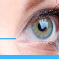 Contact Lenses