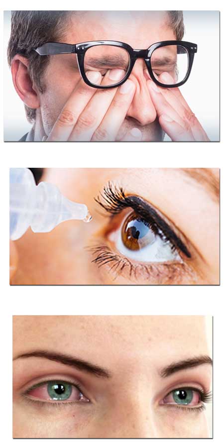 Dry Eye Conditions